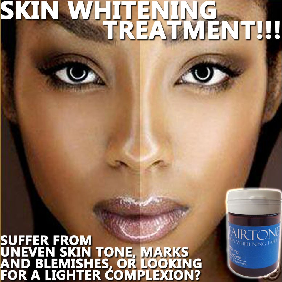 FAIRTONE SKIN LIGHTENING & WHITENING PILLS. CLEAR SKIN 